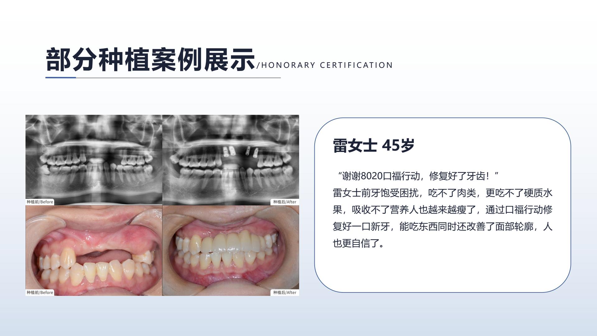 种植案例三，点击查看大图
