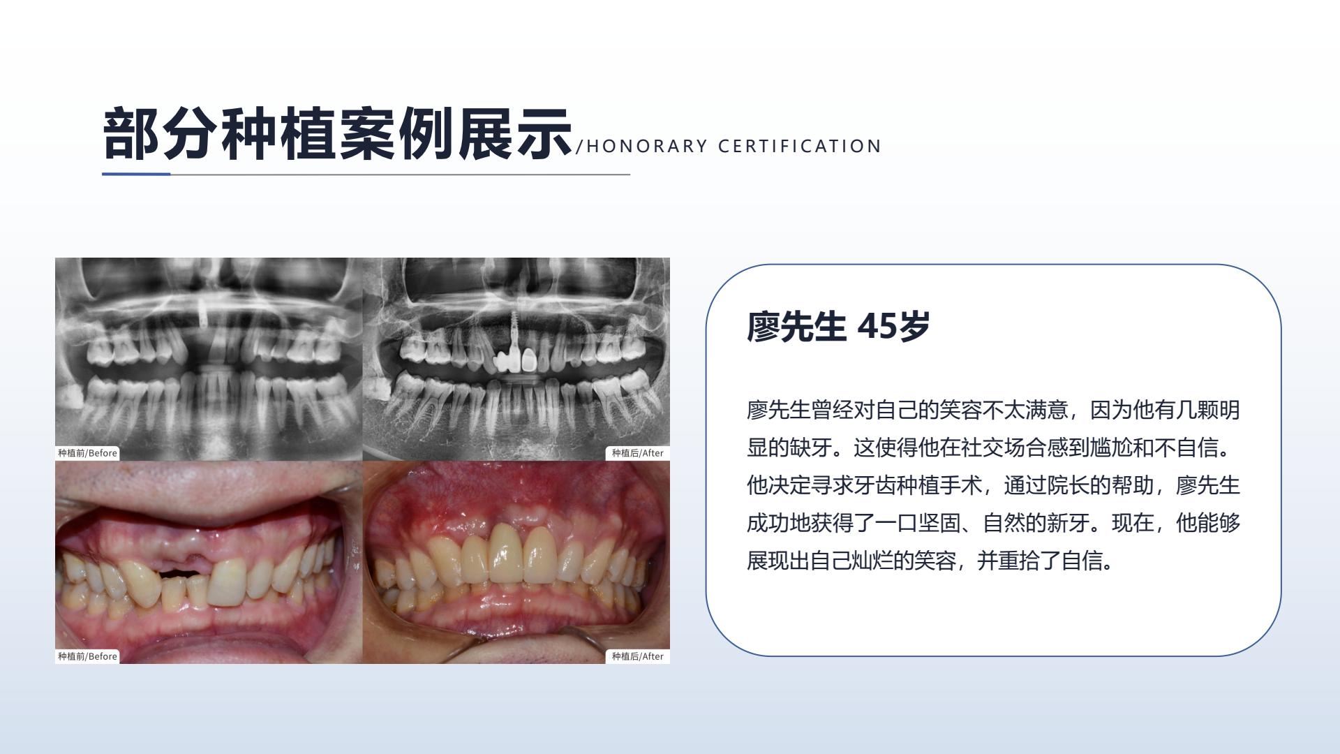 种植案例六,点击查看大图