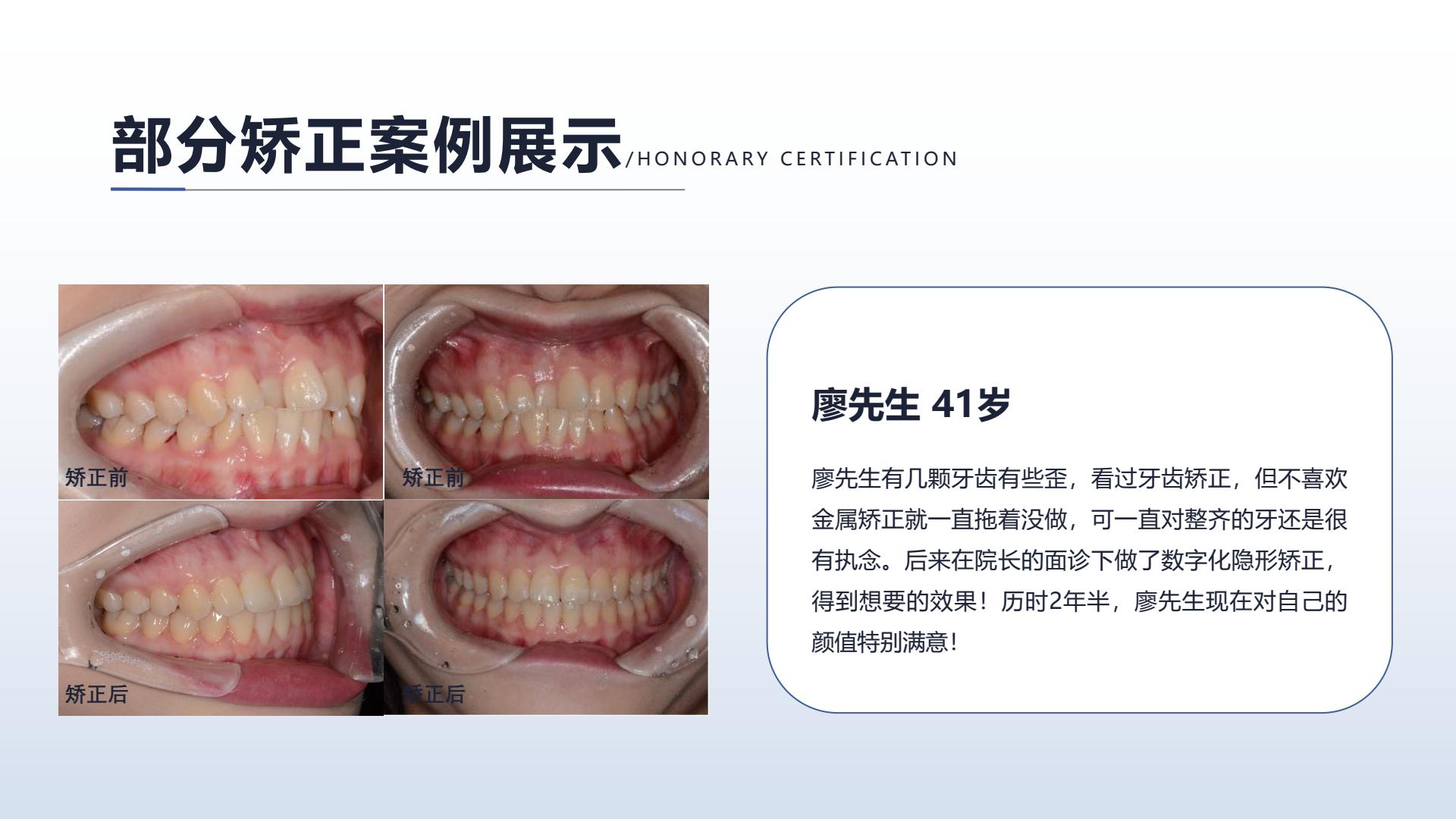 正畸案例二，点击查看大图