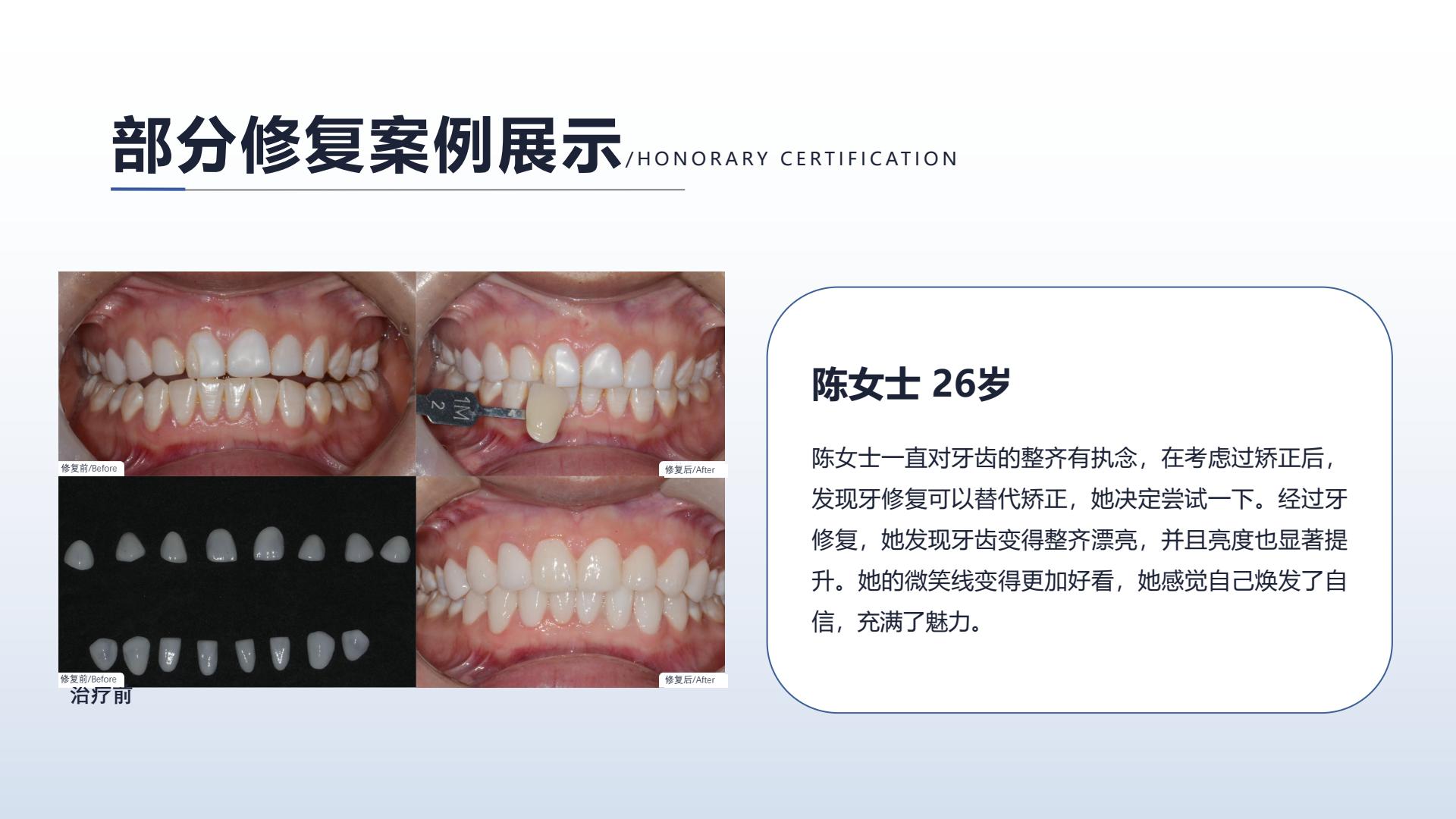 修复案例展示