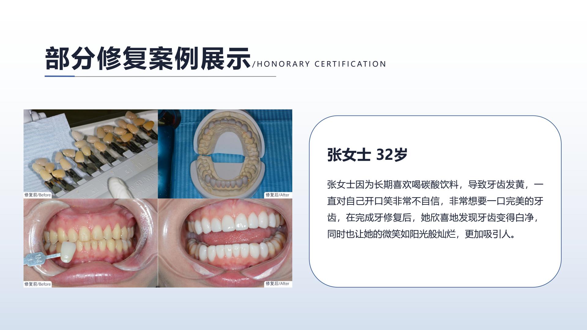 美学修复案例二，点击查看大图